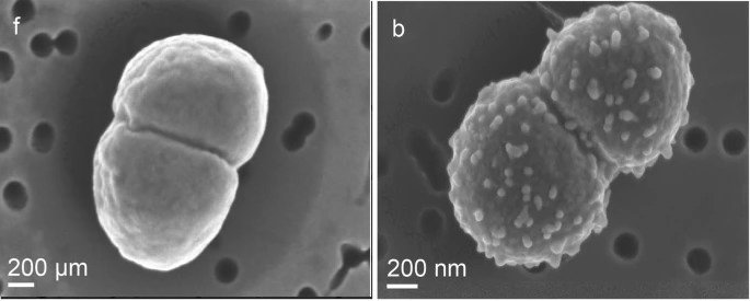 Deinococcus radiodurans