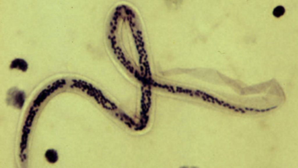 Nematodo (gusano) resucitado del permafrost siberiano: permaneció allí durante 46.000 años