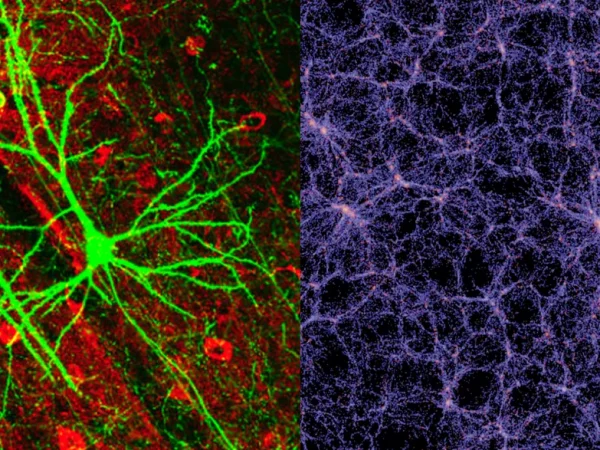 Universo cervello umano